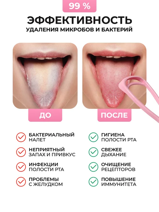 Торг Лайнс Скребок для чистки языка от налёта, розовый, фото 4