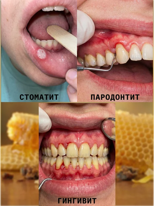 Медовый край Водный раствор прополиса, 50 мл, 1 штука, 50 мл, фото 5