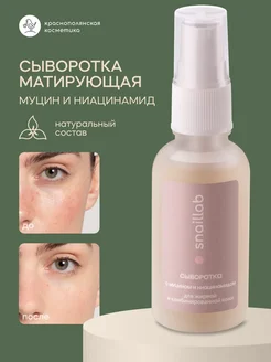 Сыворотка увлажняющая для жирной кожи лица с ниацинамидом