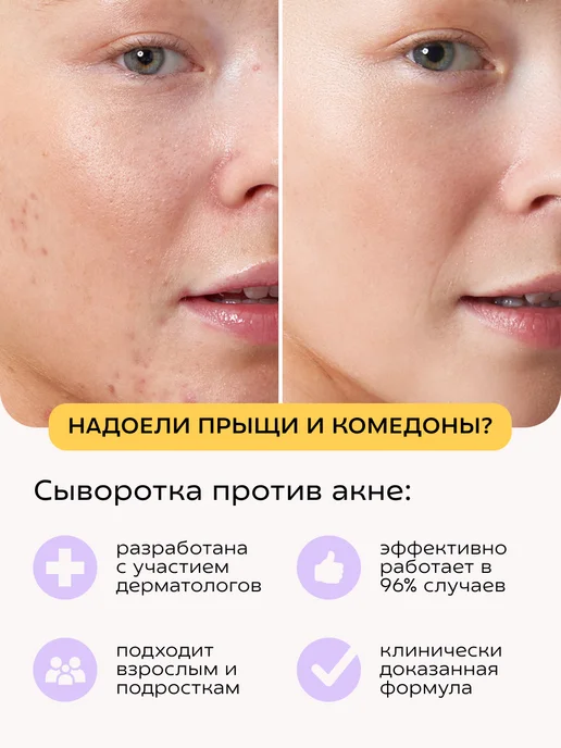 КРАСНОПОЛЯНСКАЯ КОСМЕТИКА Сыворотка увлажняющая для жирной кожи лица с ниацинамидом, красный, фото 2