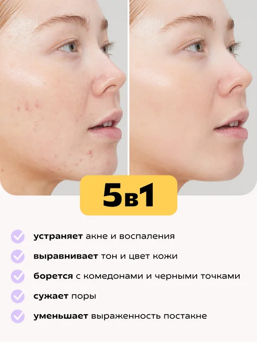 КРАСНОПОЛЯНСКАЯ КОСМЕТИКА Сыворотка увлажняющая для жирной кожи лица с ниацинамидом, красный, фото 3