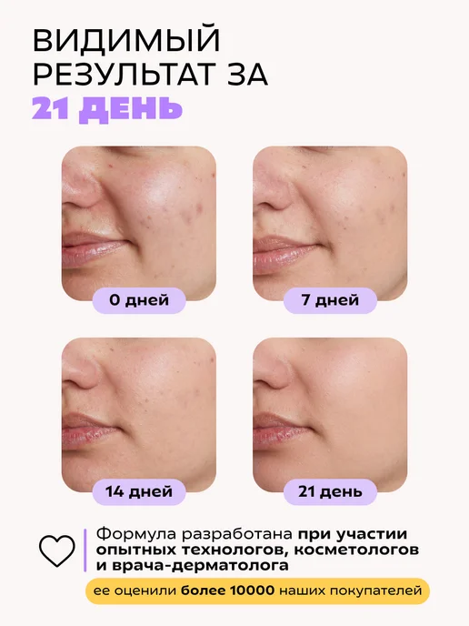 КРАСНОПОЛЯНСКАЯ КОСМЕТИКА Сыворотка увлажняющая для жирной кожи лица с ниацинамидом, красный, фото 4