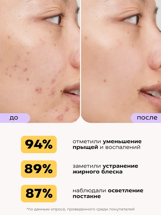 КРАСНОПОЛЯНСКАЯ КОСМЕТИКА Сыворотка увлажняющая для жирной кожи лица с ниацинамидом, красный, фото 6