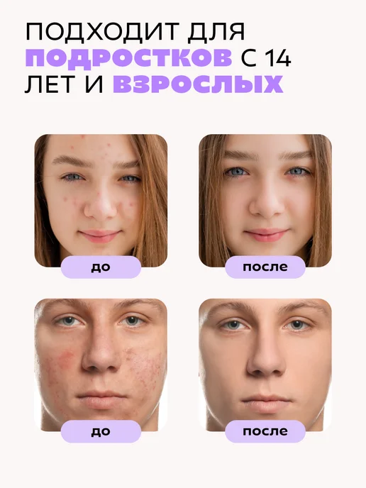КРАСНОПОЛЯНСКАЯ КОСМЕТИКА Сыворотка увлажняющая для жирной кожи лица с ниацинамидом, красный, фото 7