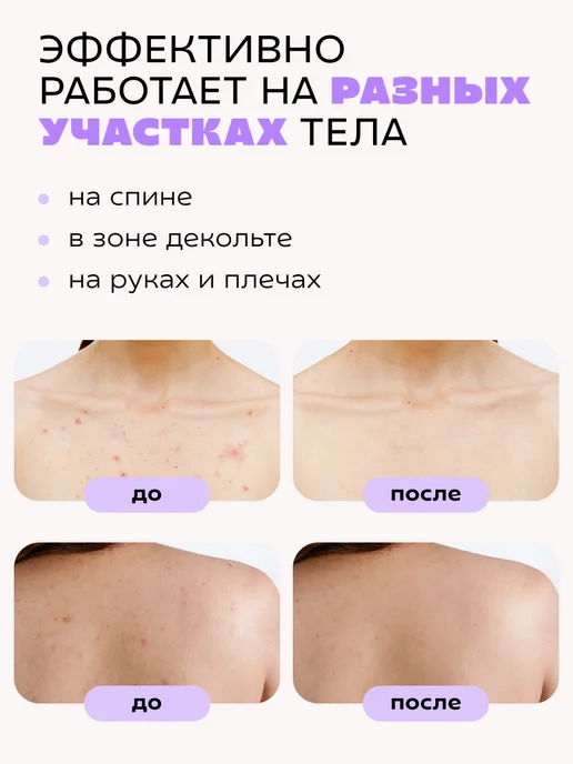 КРАСНОПОЛЯНСКАЯ КОСМЕТИКА Сыворотка увлажняющая для жирной кожи лица с ниацинамидом, красный, фото 8