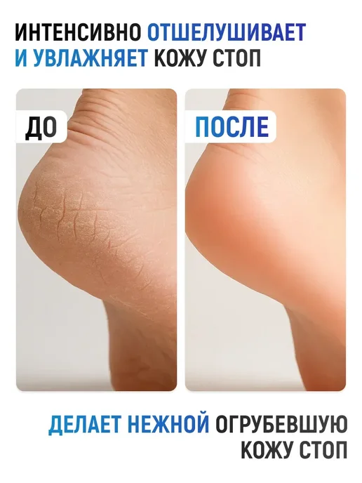 COSMEDICAL Кератолитик для пяток, вариант, фото 4