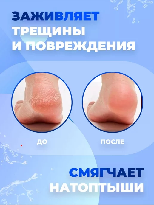 SM.Market Набор нано терка и крем от трещина, вариант, фото 4