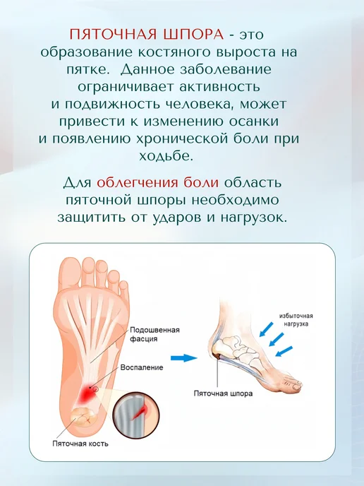 MyBalance Напяточники от пяточной шпоры, черный, фото 5