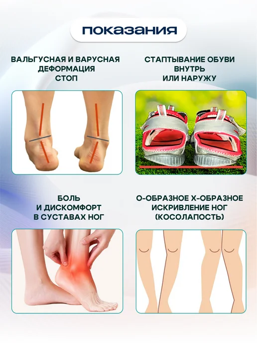 MyBalance Подпяточники клиновидные с магнитами ортопедические, белый, фото 5