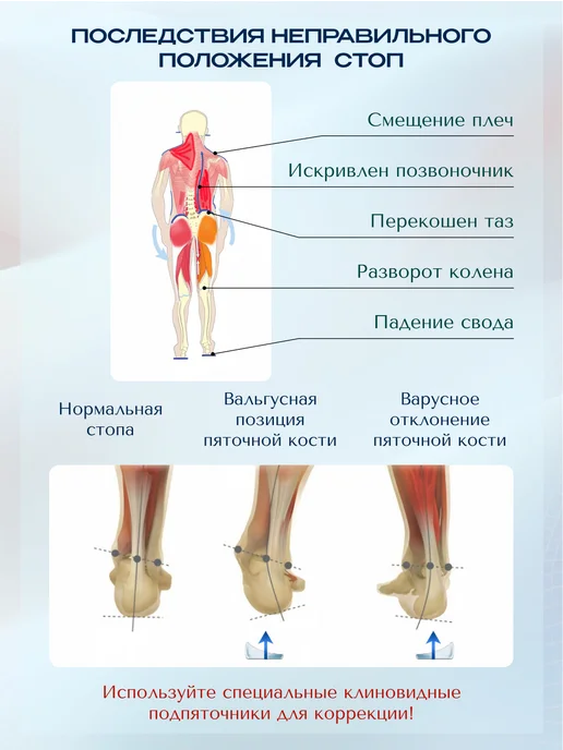 MyBalance Подпяточники клиновидные с магнитами ортопедические, белый, фото 6