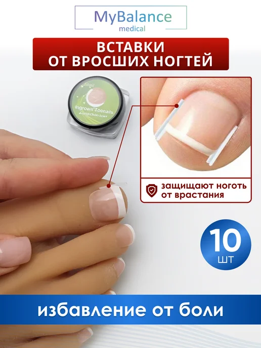 MyBalance Вставка от вросшего ногтя, белый