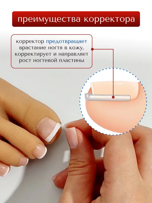 MyBalance Вставка от вросшего ногтя, белый, фото 3