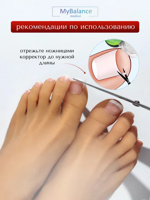 MyBalance Вставка от вросшего ногтя, белый, фото 7