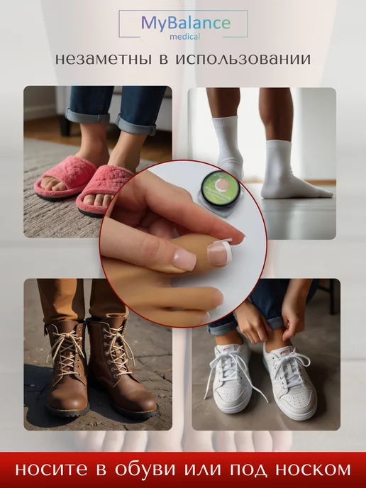 MyBalance Вставка от вросшего ногтя, белый, фото 8
