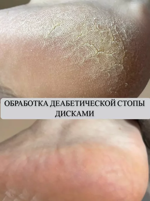 «MAСNAIL» Сменный баф-спонж-Полировщик для диска 25 мм. 25шт. Р 240, 25 шт, фото 3