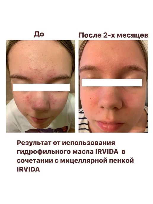 Irvida Гидрофильное масло для умывания, 150 мл, фото 7