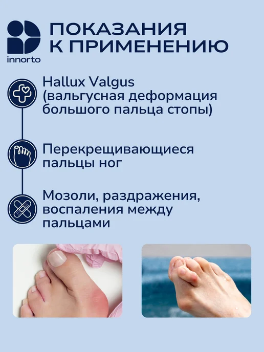 INNORTO Межпальцевые разделители для пальцев ног, белый, фото 2