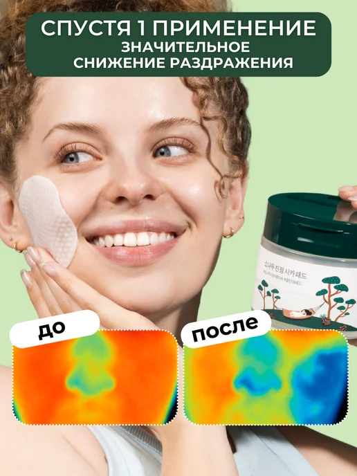 round lab Тонер пэды диски для лица от прыщей 50 шт, 50 шт, фото 4