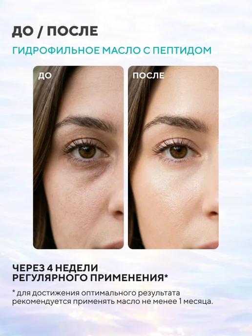 11i professional Гидрофильное масло для умывания лица. От черных точек, черный, фото 2