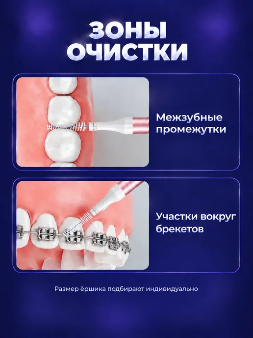ROROLL Межзубные ершики для брекетов и зубов многоразовые набор, вариант, фото 2