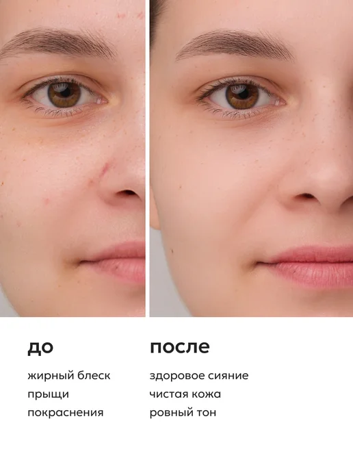 Likato professional Гель для умывания от прыщей и крем для лица, вариант, фото 3