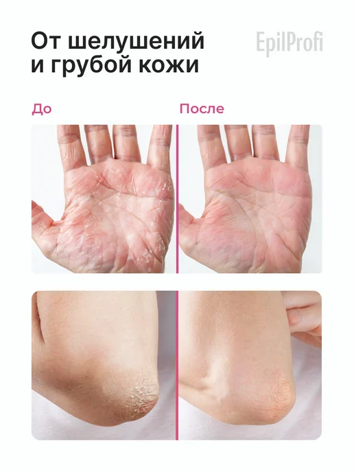 EpilProfi Ремувер для удаления кутикулы и крем воск от трещин, сухости, вариант, фото 2