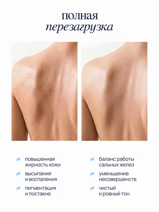 MIXIT Набор гель для душа и крем от прыщей с кислотами, вариант, фото 6