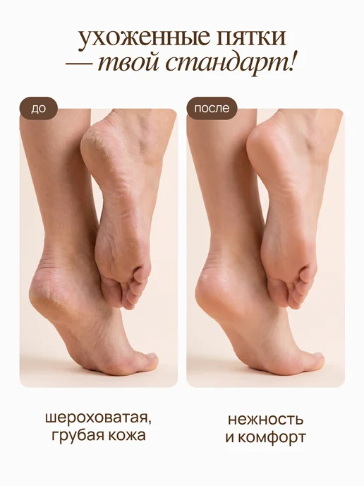 MIXIT Набор гель кератолитик, крем воск и пемза для ног, вариант, фото 3