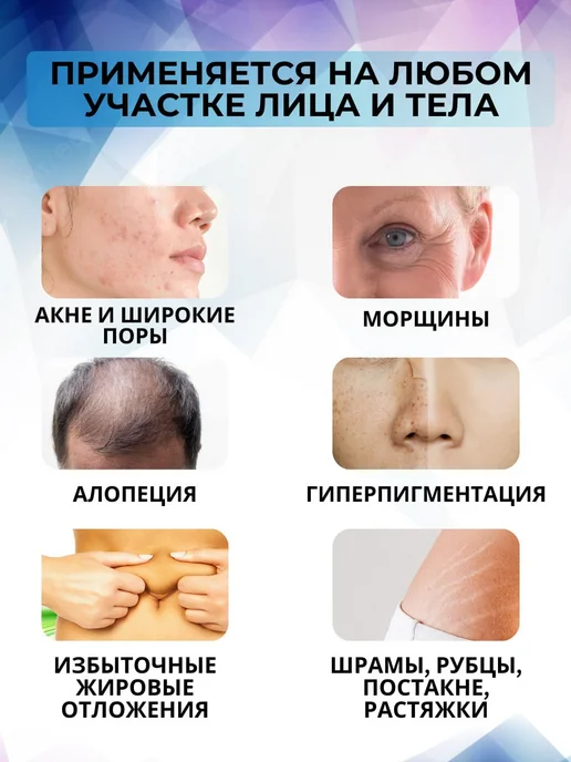 DERMAMAX Картридж 12 игл для микропена, белый Винт, 10 шт, 5 шт, фото 3