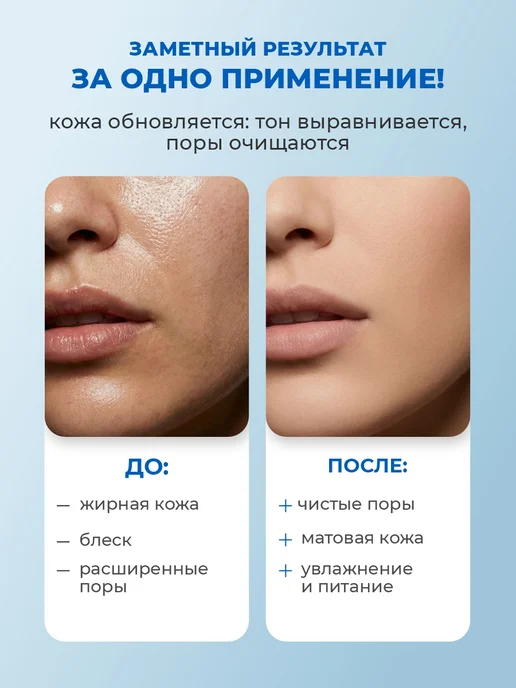 Compliment Тоник для лица кислотный Матирующий с AHA BHA кислотами 200м…, 200 м, фото 5