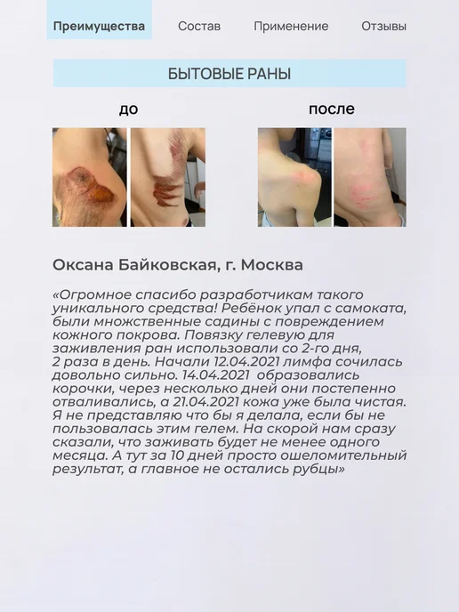 ЛИТА-ЦВЕТ Гель ранозаживляющий, от пролежней, опрелостей, 75 мл, 75 мл, фото 2