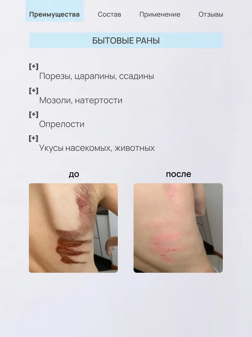 ЛИТА-ЦВЕТ Гель ранозаживляющий, от пролежней, опрелостей, 75 мл, 75 мл, фото 3