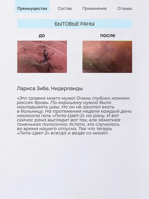 ЛИТА-ЦВЕТ Гель ранозаживляющий, от пролежней, опрелостей, 75 мл, 75 мл, фото 4