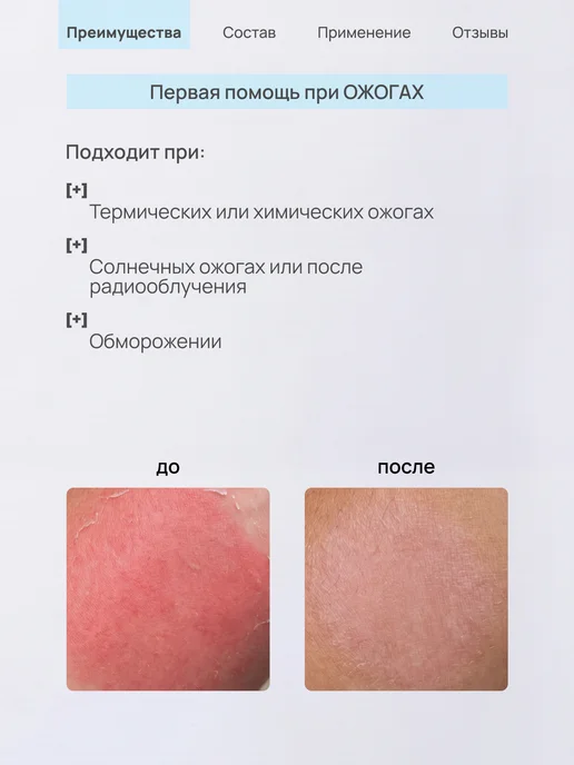 ЛИТА-ЦВЕТ Гель ранозаживляющий, от пролежней, опрелостей, 75 мл, 75 мл, фото 5
