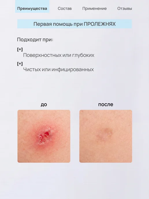 ЛИТА-ЦВЕТ Гель ранозаживляющий, от пролежней, опрелостей, 75 мл, 75 мл, фото 6
