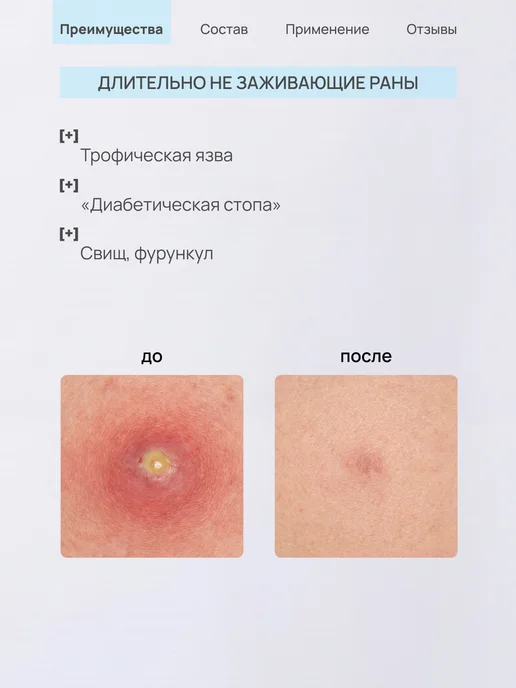 ЛИТА-ЦВЕТ Гель ранозаживляющий, от пролежней, опрелостей, 75 мл, 75 мл, фото 7
