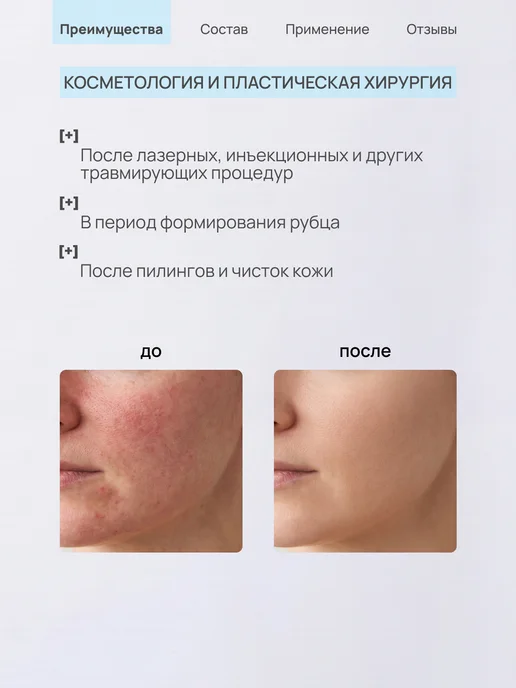 ЛИТА-ЦВЕТ Гель ранозаживляющий, от пролежней, опрелостей, 75 мл, 75 мл, фото 8